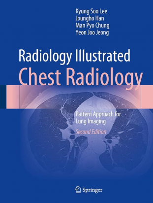 Radiology Illustrated: Chest Radiology 2nd edition