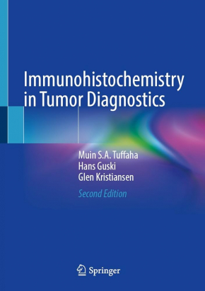 Immunohistochemistry in Tumor Diagnostics 2nd edition