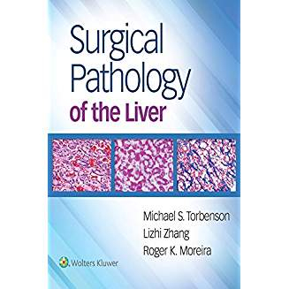 Surgical Pathology of the Liver, 1e