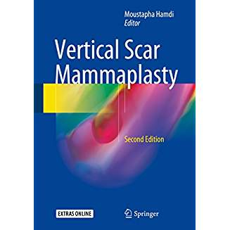 Vertical Scar Mammaplasty