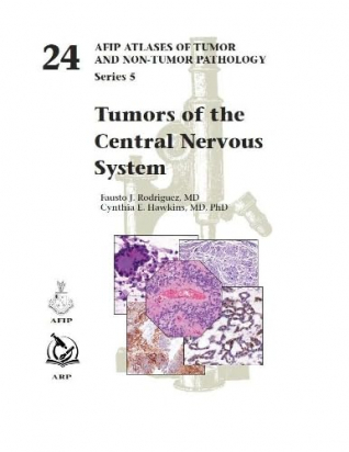 AFIP Series 5 n. 24 -  Tumors of the Central Nervous System