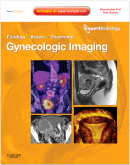 Gynecologic Imaging