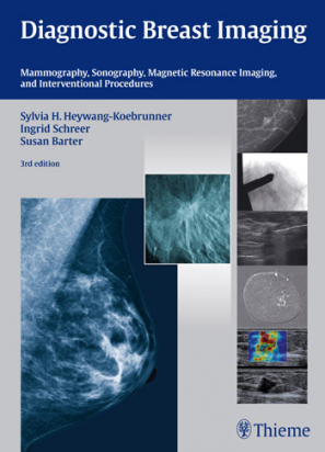 Diagnostic Breast Imaging - 3rd ed -  Mammography, Sonography, Magnetic Resonance Imaging, and Interventional Procedures