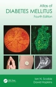 Atlas of Diabetes Mellitus 4th ed