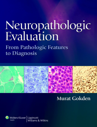 Neuropathologic Evaluation