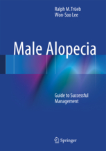 Male Alopecia