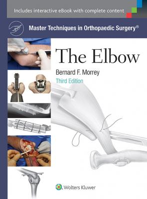 Master Techniques in Orthopaedic Surgery: The Elbow, 3e 