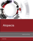 Alopecia