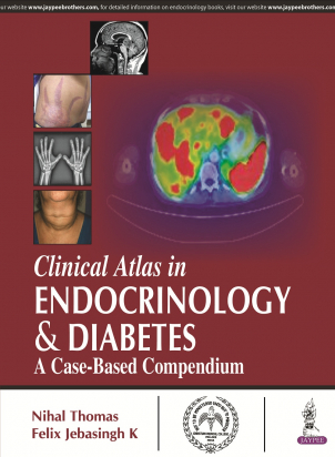 Clincal Atlas in Endocrinology &amp; Diabetes