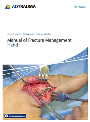 Manual of Fracture Management - Hand