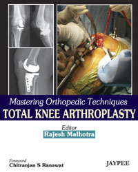 Mastering Orthopedic Techniques: Total Knee Arthroplasty