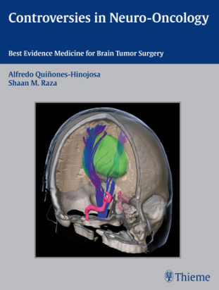 Controversies in Neuro-Oncology   Best Evidence Medicine for Brain Tumor Surgery 