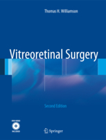 Vitreoretinal Surgery