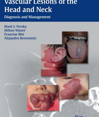 Vascular Lesions of the Head and Neck 1st ed
