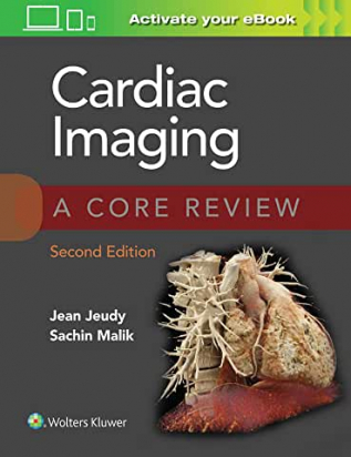 Cardiac Imaging: A Core Review Second edition