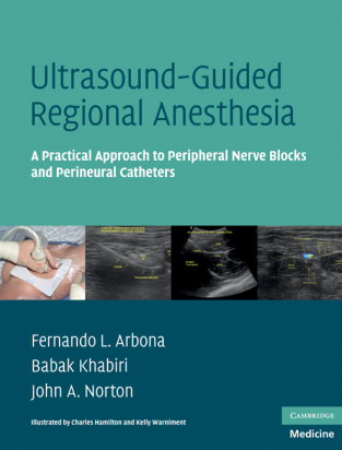 Ultrasound-Guided Regional Anesthesia