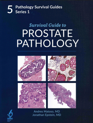 Survival Guide to Prostate Pathology (Pathology Survival Guides Series 1, Vol. 5)