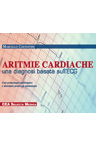 Aritmie Cardiache: Una Diagnosi Basata sull'ECG