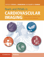 Pearls and Pitfalls in Cardiovascular Imaging