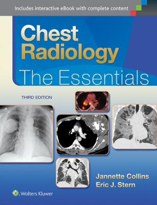 Chest Radiology, 3e 