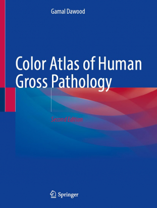 Color Atlas of Human Gross and Microscopic Pathology