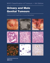 WHO Classification of Tumours,  Urinary and Male Genital Tumours 5th Edition, Volume 8