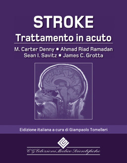 Stroke. Trattamento in acuto