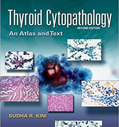 Thyroid Cytopathology, 2e