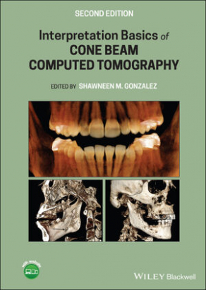 Interpretation Basics of Cone Beam Computed Tomography, 2nd Edition