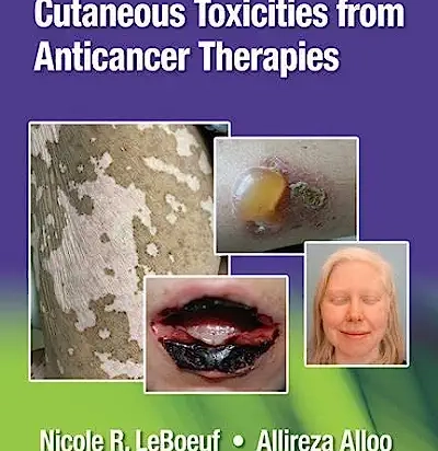 Cutaneous Reactions from Anti-Cancer Therapies