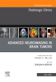Advanced Neuroimaging in Brain Tumors, An Issue of Radiologic Clinics of North America, Volume 59-3