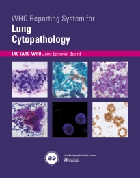 WHO Reporting System for Lung Cytopathology  VOL. 1