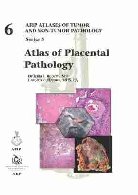 AFIP Series 5 Fasc. N. 6 -Atlas of Placental Pathology