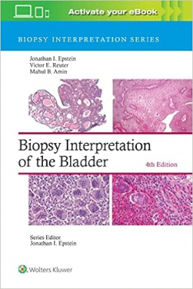 Biopsy Interpretation of the Bladder, Fourth edition