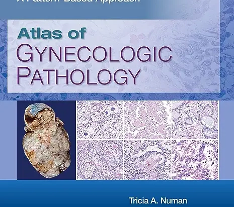 Atlas of Gynecologic Pathology A Pattern-Based Approach, First edition