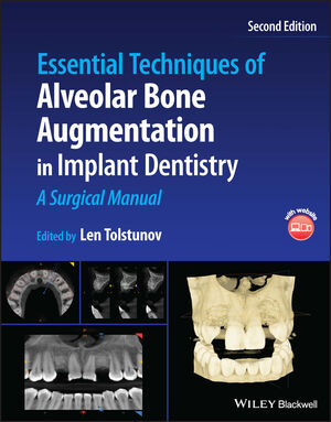 Essential Techniques of Alveolar Bone Augmentation in Implant Dentistry: A Surgical Manual, 2nd Edition