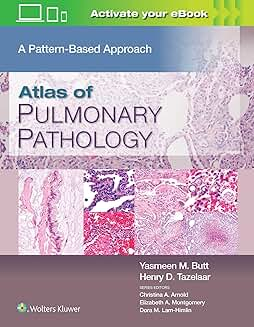 Atlas of Pulmonary Pathology, First edition