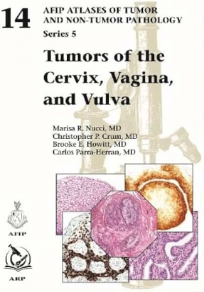 AFIP series 5 Fasc. 14  Tumors of the Cervix , Vagina , and Vulva