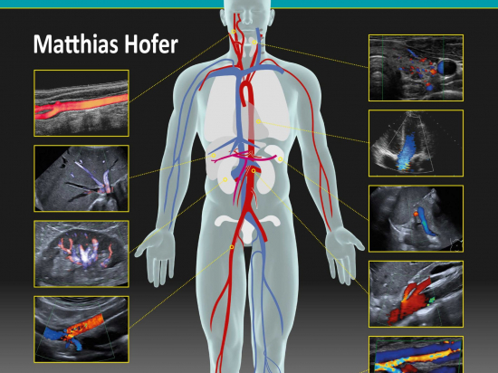 Eco-Colordoppler