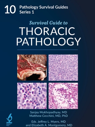 Survival Guide to Thoracic Pathology - Volume 10