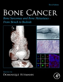 Bone Cancer, 3rd Edition